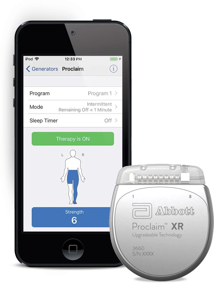 Abbott Proclaim XR spinal cord stimulation generator beside its patient controller showing therapy settings