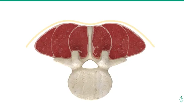 Axial anatomical illustration of a lumbar vertebra and the deep posterior spinal muscles