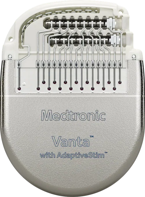 Medtronic Vanta recharge-free spinal cord stimulation generator