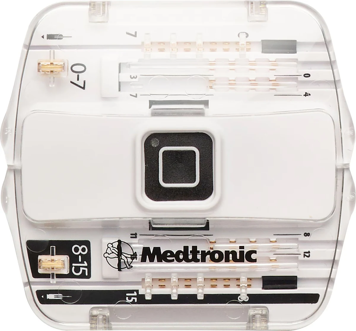 Medtronic wireless external neurostimulator used during an SCS trial